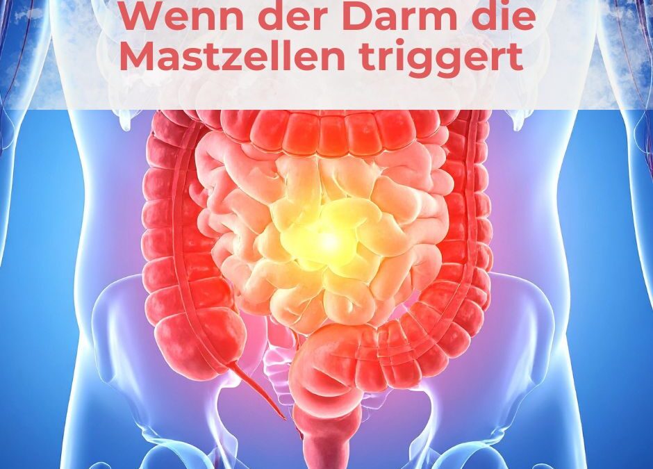 Wenn der Darm die Mastzellen triggert – SIBO, IMO und Fehlbesiedlungen als Auslöser